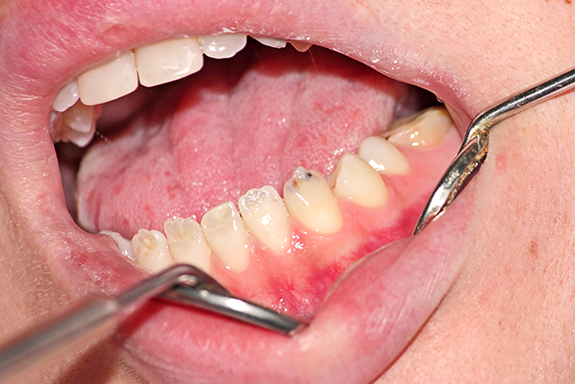 the-origins-of-tooth-enamel