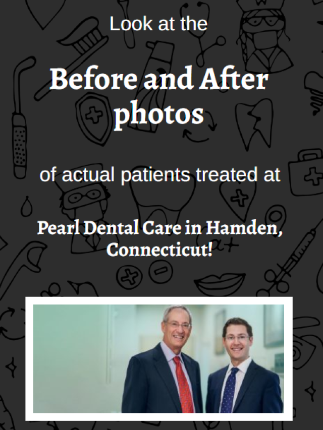 Before and after photos of actual patients treated at Pearl Dental Care