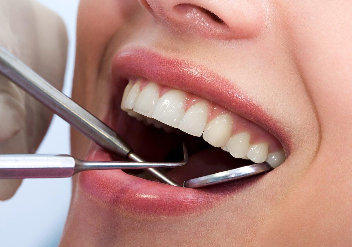 Professional Teeth Whitening in Hamden CT Area